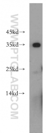 11979-1-AP - EXOSC8