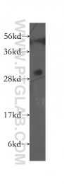 11979-1-AP - EXOSC8