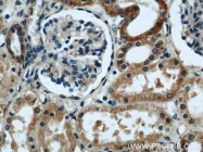 22658-1-AP - EYA1