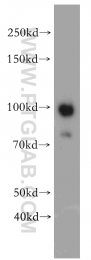 21800-1-AP - EZH2 / KMT6