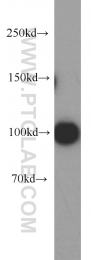 21800-1-AP - EZH2 / KMT6