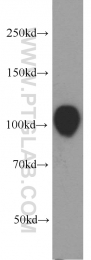 21800-1-AP - EZH2 / KMT6