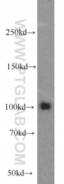21800-1-AP - EZH2 / KMT6
