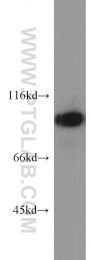 21800-1-AP - EZH2 / KMT6