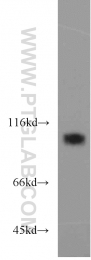 21800-1-AP - EZH2 / KMT6