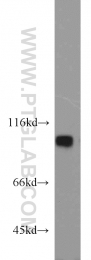 21800-1-AP - EZH2 / KMT6