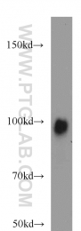 21800-1-AP - EZH2 / KMT6