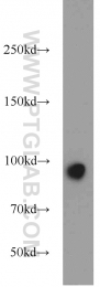21800-1-AP - EZH2 / KMT6
