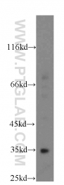 20127-1-AP - FAM49B