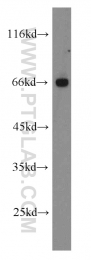 10215-1-AP - XRCC9 / FANCG