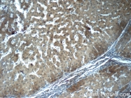 15841-1-AP - Fibrinogen gamma chain