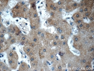 15841-1-AP - Fibrinogen gamma chain