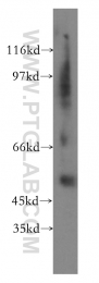 15841-1-AP - Fibrinogen gamma chain