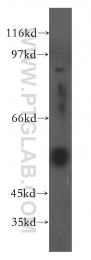 15841-1-AP - Fibrinogen gamma chain