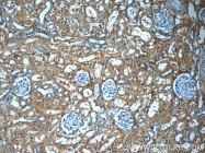 66158-1-Ig - Fibrinogen gamma chain