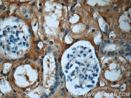 66158-1-Ig - Fibrinogen gamma chain