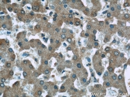 66158-1-Ig - Fibrinogen gamma chain