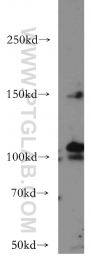 20712-1-AP - VEGFR-3 / Flt-4