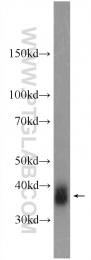 23355-1-AP - Folate receptor alpha