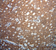 13536-1-AP - Fascin-3