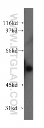 13536-1-AP - Fascin-3
