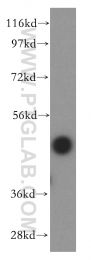 16567-1-AP - Fucosyltransferase 6