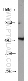 15164-1-AP - Galactokinase 2