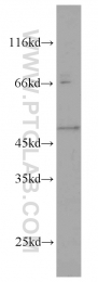 15164-1-AP - Galactokinase 2