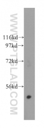 15164-1-AP - Galactokinase 2