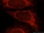 15518-1-AP - Beta-galactosidase