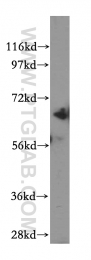 15518-1-AP - Beta-galactosidase