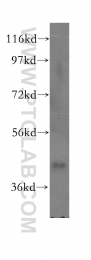 16551-1-AP - GLI4