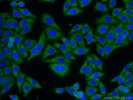 10247-2-AP - Transducin beta chain 1 / GNB1