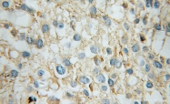 10247-2-AP - Transducin beta chain 1 / GNB1