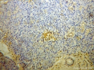 10247-2-AP - Transducin beta chain 1 / GNB1