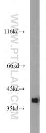 10247-2-AP - Transducin beta chain 1 / GNB1