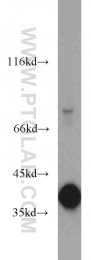 10247-2-AP - Transducin beta chain 1 / GNB1