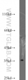 10247-2-AP - Transducin beta chain 1 / GNB1