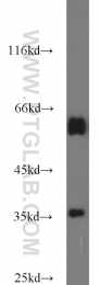 10247-2-AP - Transducin beta chain 1 / GNB1