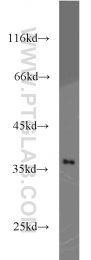 10247-2-AP - Transducin beta chain 1 / GNB1