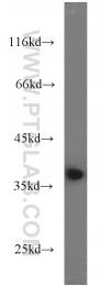 10247-2-AP - Transducin beta chain 1 / GNB1