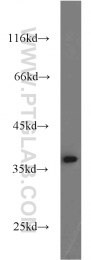 10247-2-AP - Transducin beta chain 1 / GNB1