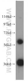 10247-2-AP - Transducin beta chain 1 / GNB1