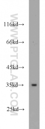 10081-1-AP - Transducin beta chain 3 (GNB3)