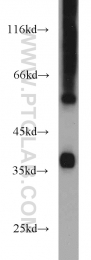 11978-2-AP - Transducin beta chain 4 (GNB4)
