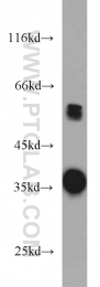 11978-2-AP - Transducin beta chain 4 (GNB4)