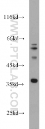 11978-2-AP - Transducin beta chain 4 (GNB4)