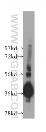 11978-2-AP - Transducin beta chain 4 (GNB4)