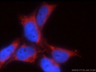 20728-1-AP - GnRH receptor II / GNRHR2