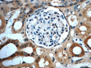 20728-1-AP - GnRH receptor II / GNRHR2
